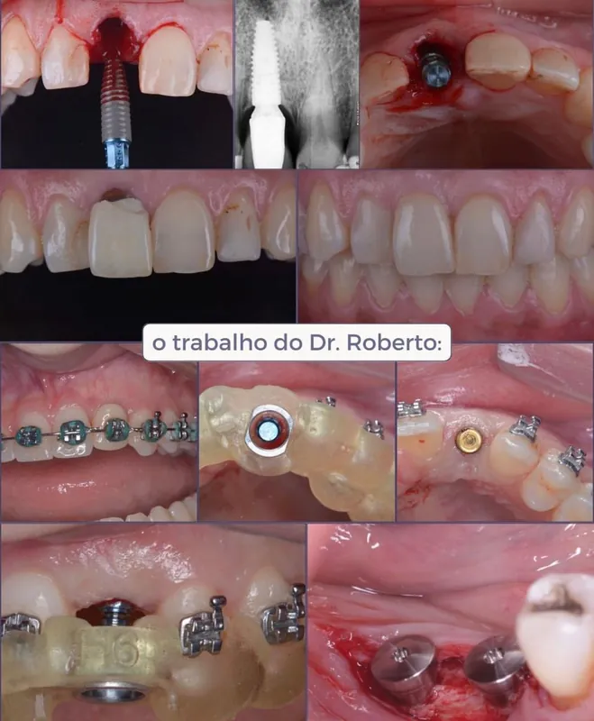 Cirurgias