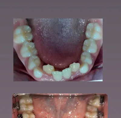 Estética Dental